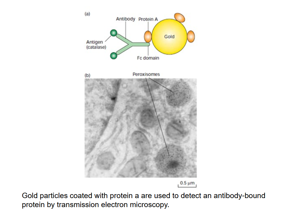 Secondary antibody in electron microscopy